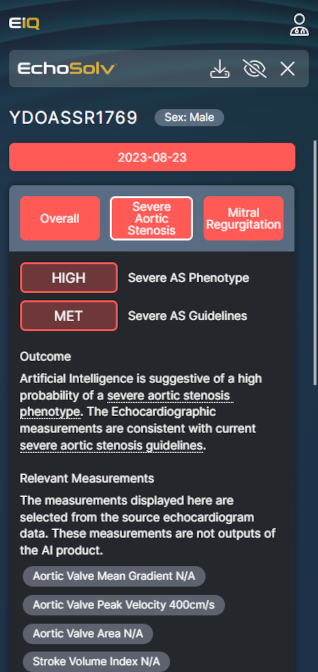 Picture of EchoSolv Patient details page