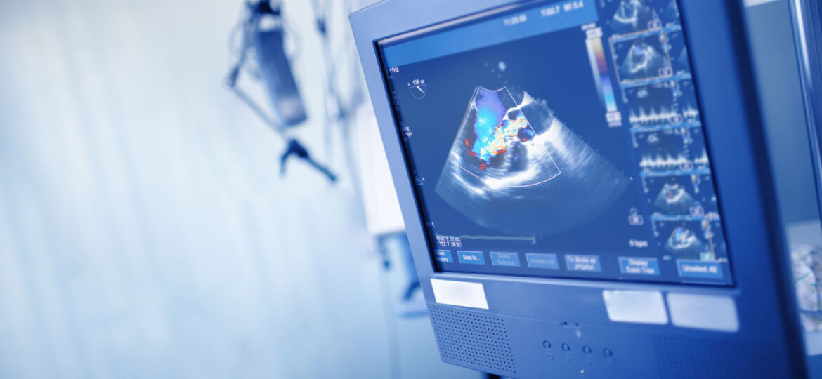 Heart monitor