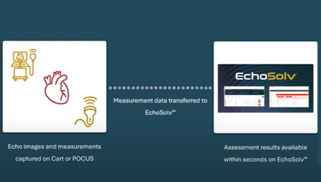 Implementation Overview for EchoSolv Worldwide