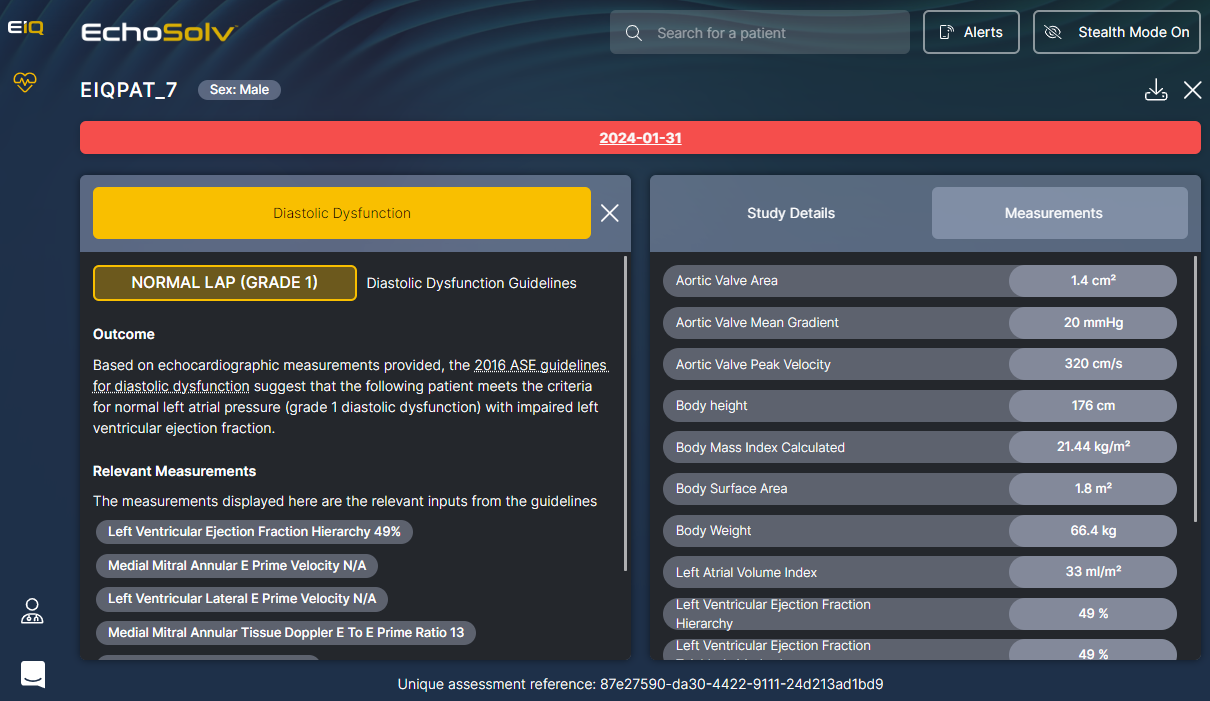 Image of the EchoIQ Diastolic Dysfunction Dashboard