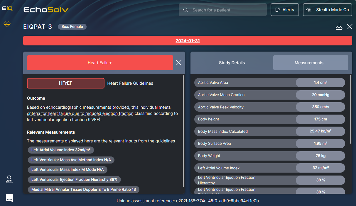 EchoSolv Heart Failure Dashboard